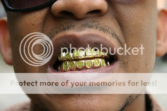 goldteeth.jpg